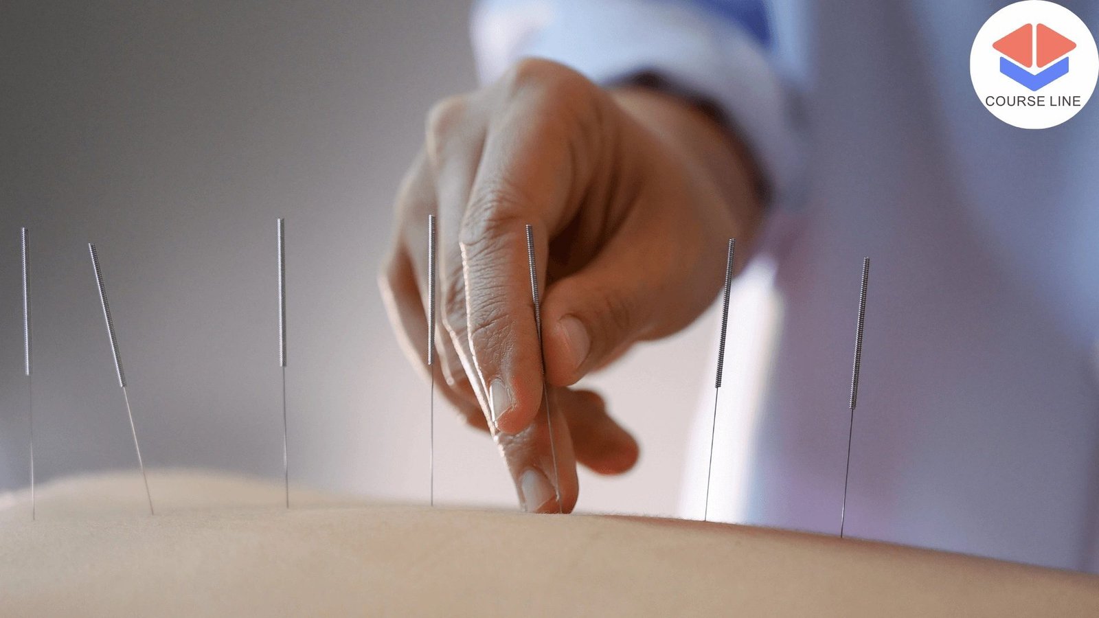 Acupuncture for Pain Relief and Well-Being Course Thumbnail